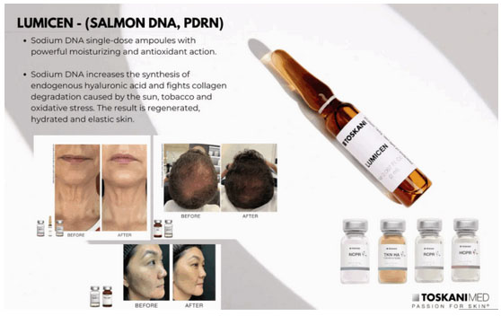 Scar Repair Treatments Peachtree Georgia GA, Microneedling with Regenerative Salmon DNA (PDRN) Peachtree Georgia GA, Microneedling Scar Repair Treatments Peachtree GA,  Microneedling Peachtree GA, what does microneedling do, Regenerative Salmon DNA (PDRN) Peachtree GA, LUMICEN PDRN 3% by Toskani Peachtree GA, Fotona® Laser Scar Treatment near me Peachtree GA, Fotona® laser system Peachtree GA, Georgia Wellness Solutions & Med Spa, does microneedling work, Scar Repair Near Me Griffin GA